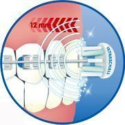 Ultraschall Mundhygiene